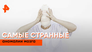 «Загадки человечества»: самые странные аномалии мозга